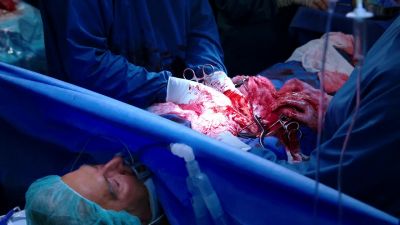 I can't get it
to lay posteriorly. - Chicago Med