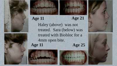 I could then compare them, - Open Wide