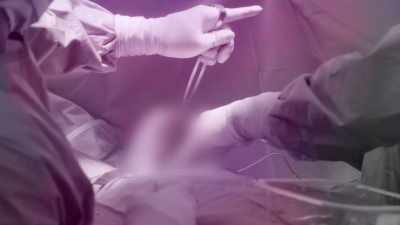 I did my boobs and my
labiaplasty at the same time. - The Secret Lives of Mormon Wives