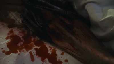 I found scratches
all over his lower legs. - Haunted Hospitals