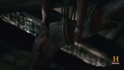 Fracture detected. - Vikings