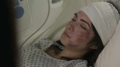I guess it's normal for patients
with traumatic brain injury - What If