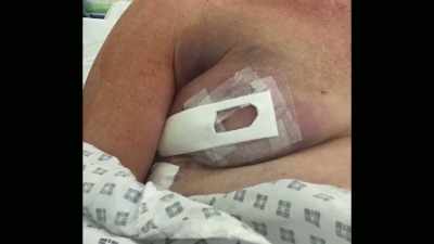 I had this alien on my chest,
I was in constant pain, - Naked Education