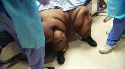 I HATE MYSELF BECAUSE I ALLOWED
MYSELF TO GET THIS SIZE. - My 600-lb Life