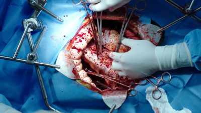 I have a specific
criteria for... - The Resident
