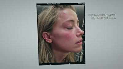 I have no mercy.
She will hit the wall hard." - Johnny vs Amber: The US Trial