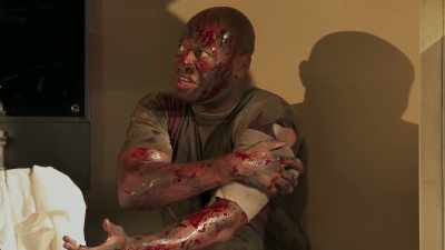 I have some wounds
upon me and they smart - Coriolanus
