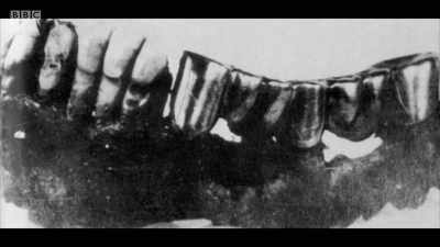 I held the dental bridge
in my hand, - Berlin 1945