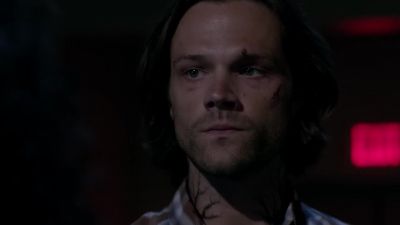 I know you're dying. - Supernatural