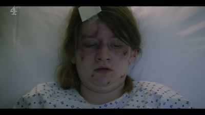 - I know you're still
not at your best, - The Accident