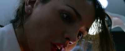 I need you to squeeze it now.
Squeeze it hard - Ambulance
