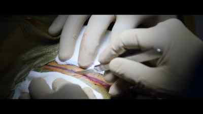 I saw your wife
before we started and I said hi to her. - The Surgeon's Cut