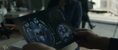 I spoke with a neurologist,
and she said - The Terminal List