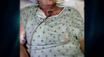 I want to know what
happened that paralyzed me." - Dr. Death: The Undoctored Story