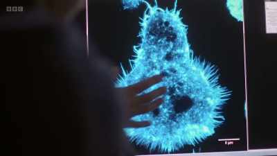 If another cell touched that region,
then these spikes would sense - The Human Body: Secrets of Your Life Revealed