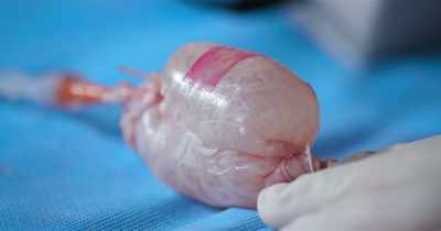 If you have this much pressure
in your intestine - White Rabbit Project