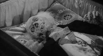 If we look at the base of a brain - Young Frankenstein