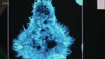 If you said, what does a natural
killer cell look like? I'd go, - The Human Body: Secrets of Your Life Revealed