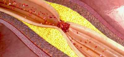 If these enzymes are blocked, - Root Cause