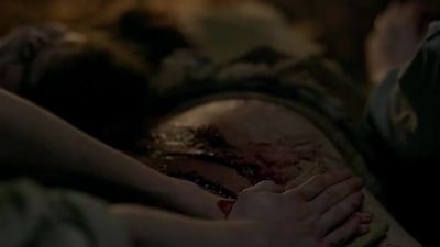 I'm going to have
to tie off his blood vessels. - Outlander