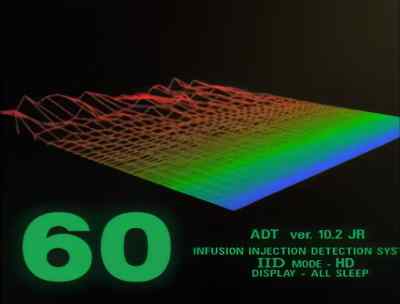 I'm only getting one wave
pattern... from the bedroom. - Time Trax