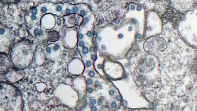 In 2020, electron microscopes
helped to identify a new virus - - Secrets of Size: Atoms to Supergalaxies
