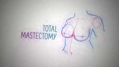 In Gina's case, she had a total
mastectomy, which is a surgical - Naked Education