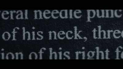 In my opinion, some of
these needle puncture marks, - Who Killed Robert Wone?