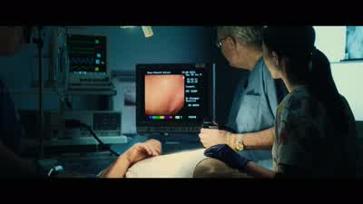 In the mid transverse colon. - Uncut Gems