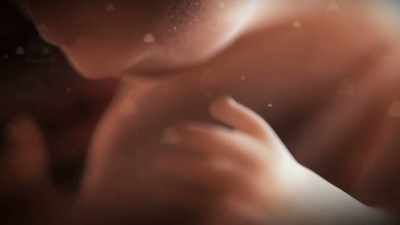 In utero exposures
are most often linked - Toxic Beauty