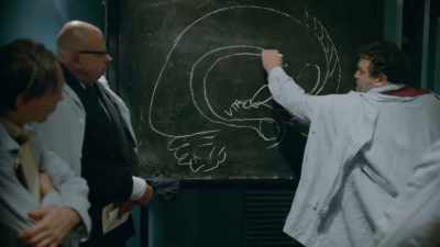 In this whole emotional cortex, - DAU. Degeneration