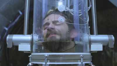 [inhales sharply] - The OA