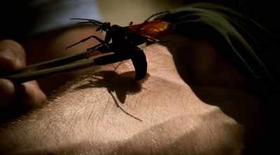 Initially it is like
a searing, hot pain. - Kings of Pain