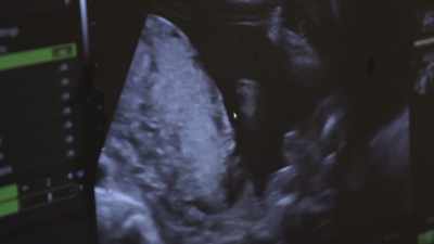 -Inside the brain, - Human: The World Within