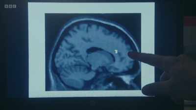 Is this bravery, basically?
Is bravery your prefrontal
cortex going, - The Human Body: Secrets of Your Life Revealed