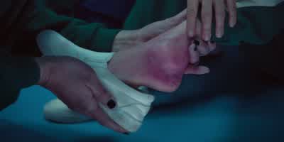 Is it sprained? - Squid Game