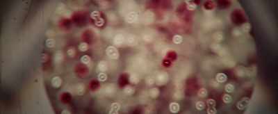 Isolated cases of a zombie virus - Eat Brains Love
