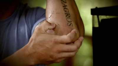 It is 100% a burning pain.
It definitely hurt. - Kings of Pain