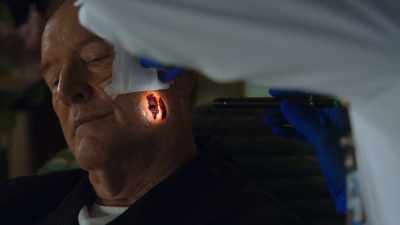 It constricts the vessels,
slows the healing. - The Good Doctor