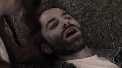 It hurts.
- I know. - Z Nation