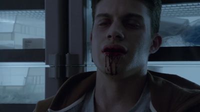 It hurts. It hurts. - Teen Wolf