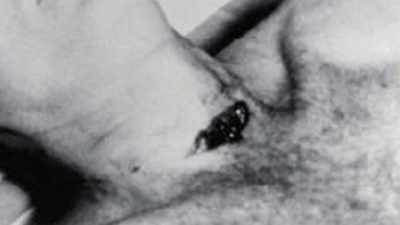 It looked like a gaping gash. - JFK: What The Doctors Saw
