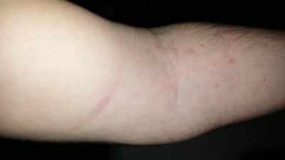 It looks like a burn or something. - Murder Death Koreatown