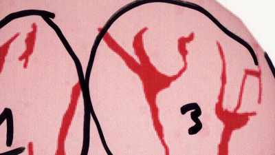 IT LOOKS LIKE
A PITCHFORK SORT OF A FORM. - An American Murder Mystery: The Staircase