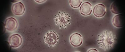 It looks like the alien cells are somehow - The Thing