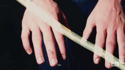 It was the fifth metacarpal, - The Preppy Murder: Death in Central Park
