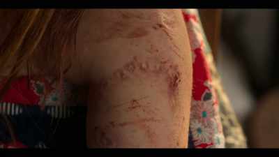 It took a chunk
right out of my arm, - Wolf Like Me