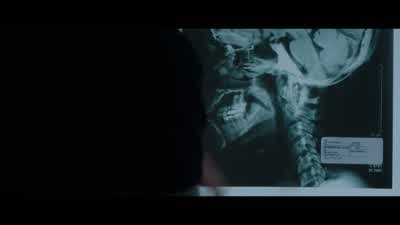 It was simply the wrong name on an X-ray. - Jigsaw