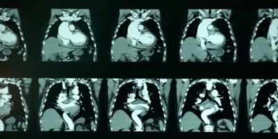 It wasn't the first miscarriage, - The Fear Index