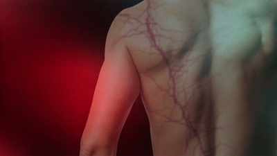 It's a Lichtenberg figure,
so called, across his back, - The UnBelievable with Dan Aykroyd
